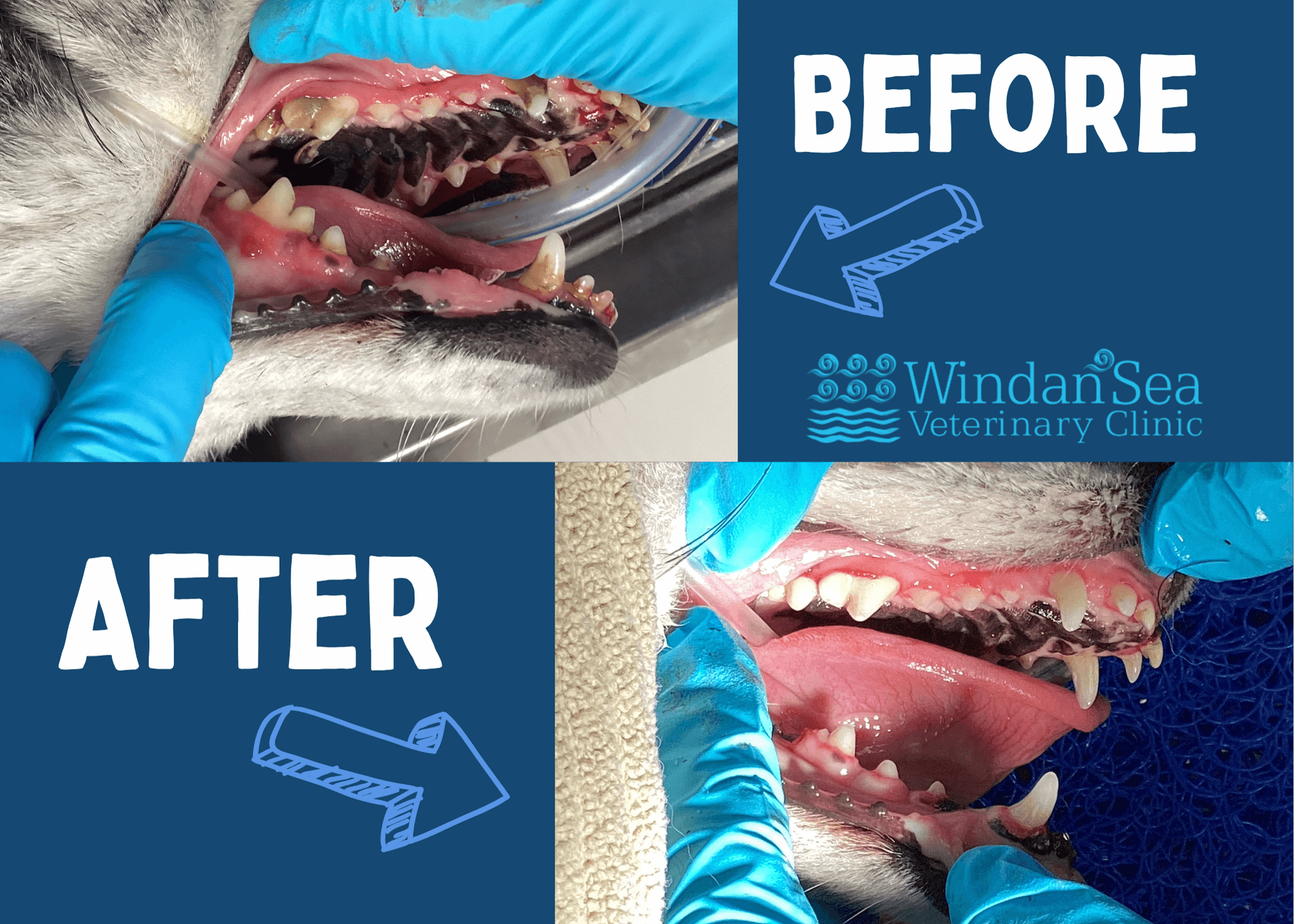 Before and after dental cleaning comparison photos